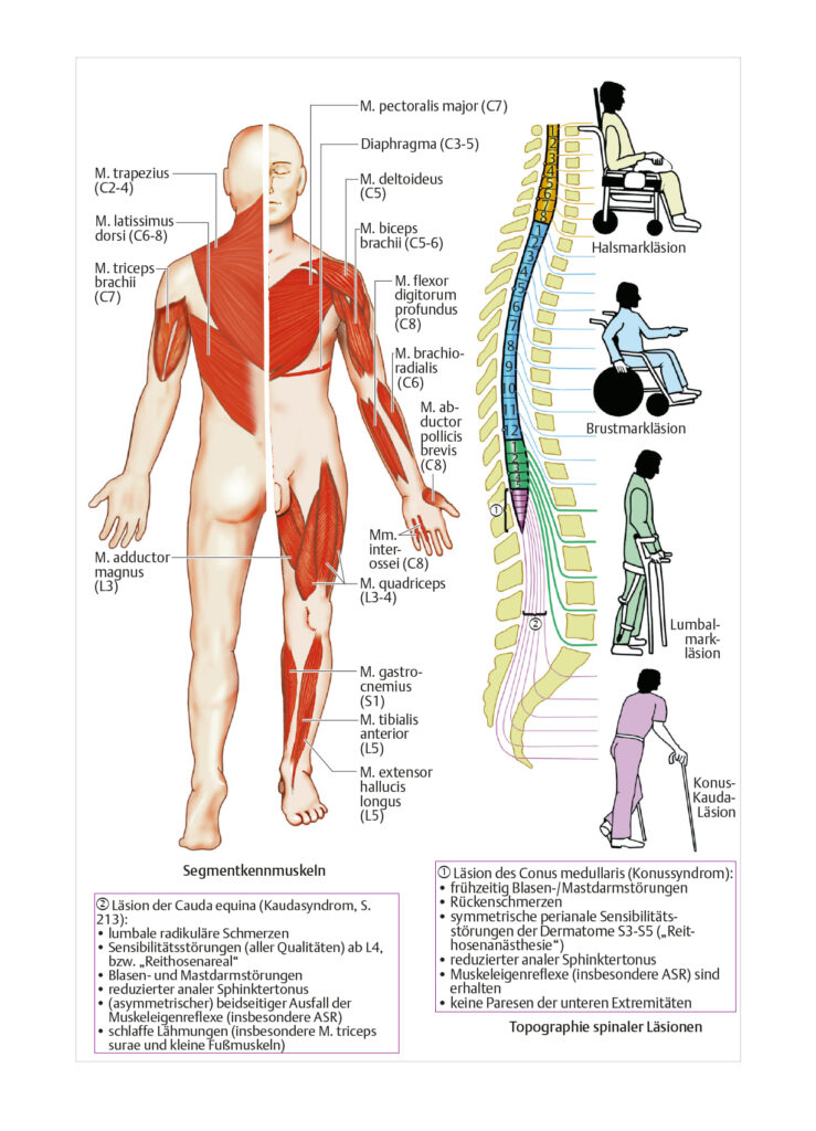 Rückenmarktrauma