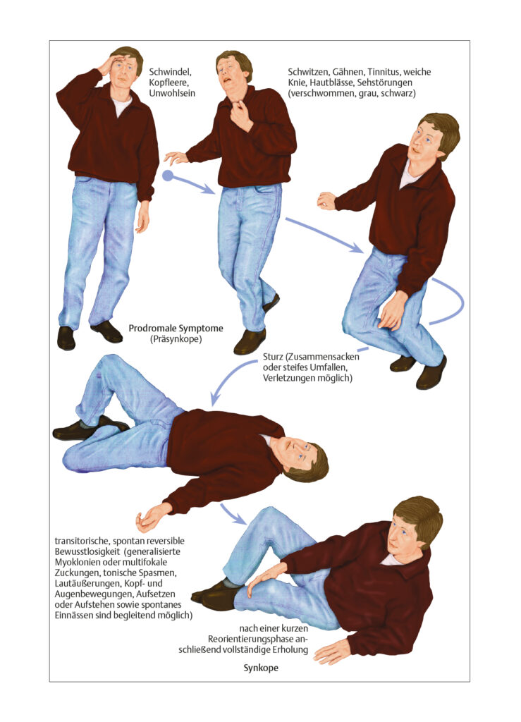 Nichtepileptischer Anfall