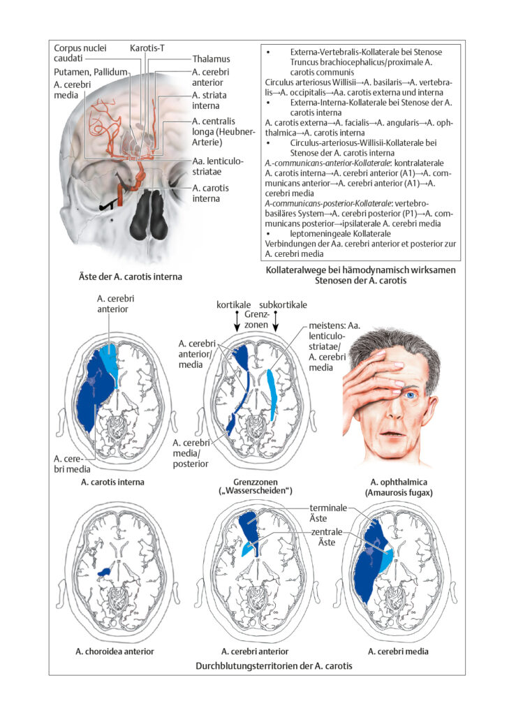Zerebrovaskuläre Syndrome