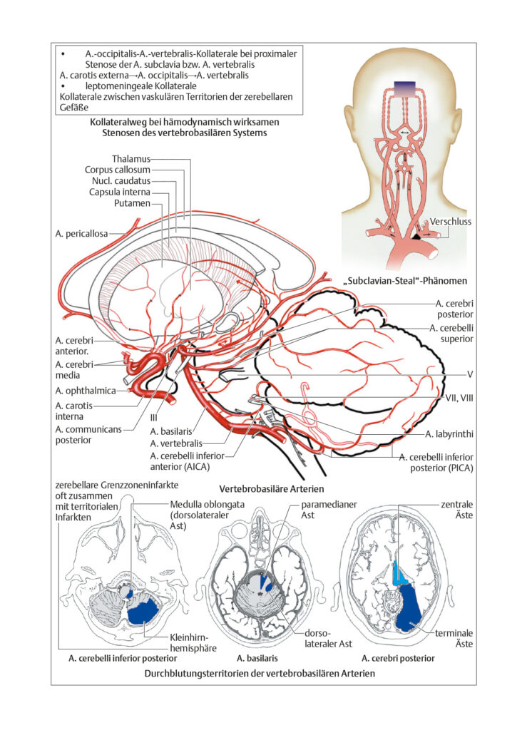 Zerebrovaskuläre Syndrome