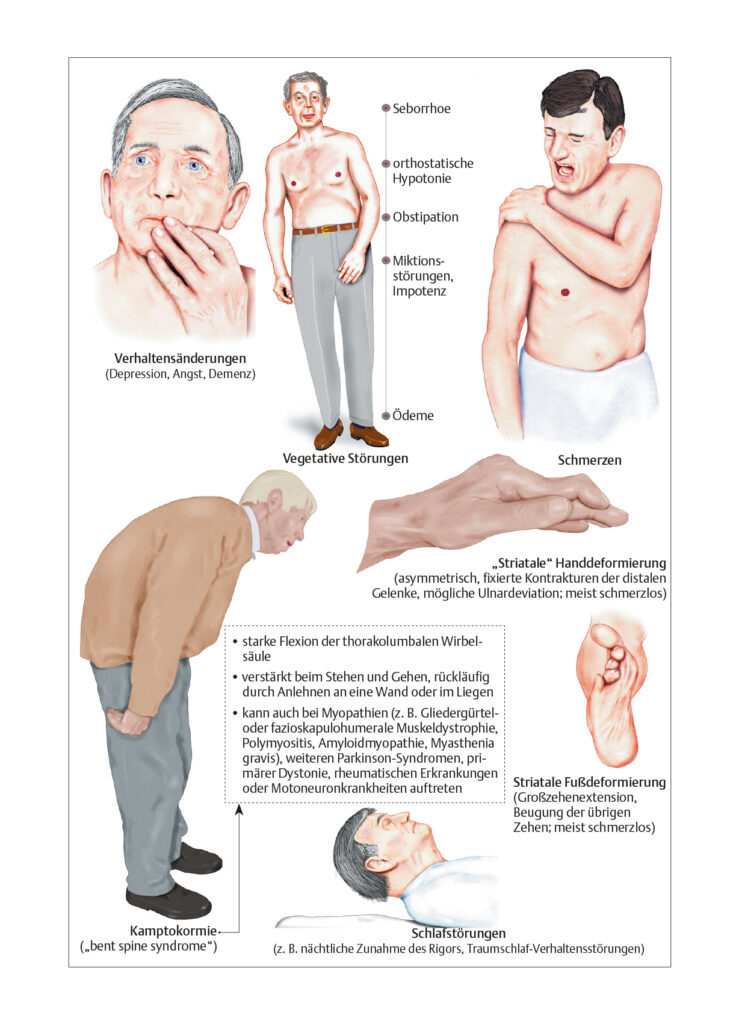 Parkinson-Syndrom